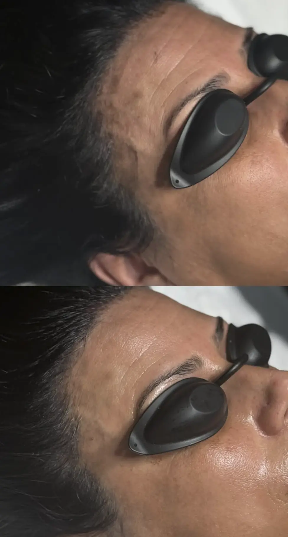 dermaplaning course cape town